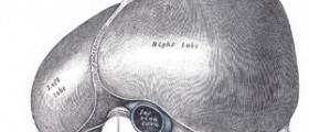 Liver cysts causes