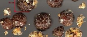 Natural cure for gallstones - keep your gallbladder and pass your gallstones