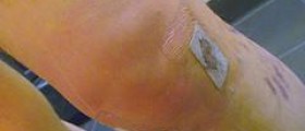Natural therapy for joint pain