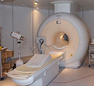 Optic neuritis: MRI of optic nerve
