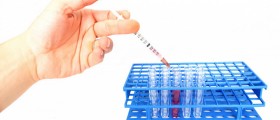 Experimental Aids Vaccine Shows Promising Results In Monkeys