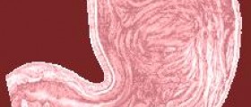 Prevention of dumping syndrome