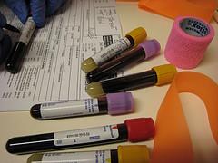 Prevention of hyperlipidemia