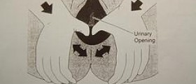 Prevention of perineal trauma