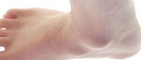Prevention of synovitis