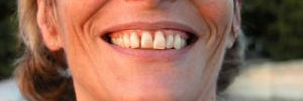 Reversing gum disease