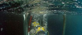 Scuba ear problems after diving