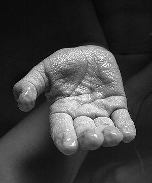 Skin care and wrinkle prevention