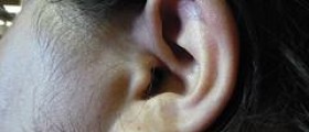 Some deafness facts