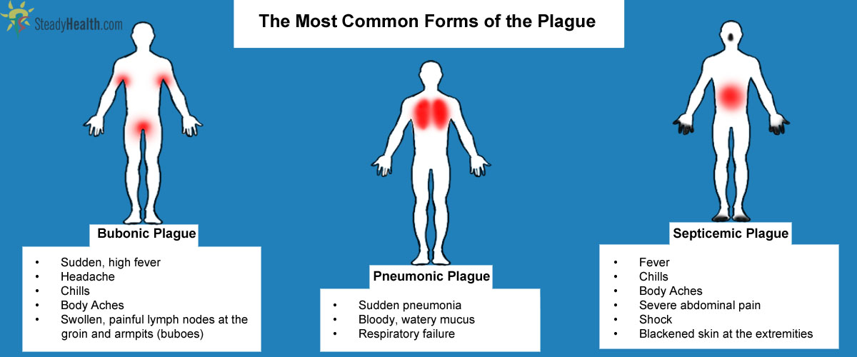 Image result for pneumonic plague symptoms