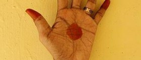 Traditional Tibetan medicine - Holistic approach to health care