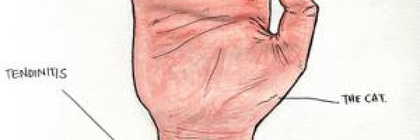 Treat carpal tunnel syndrome with acupuncture