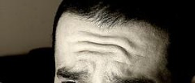 Wrinkles on forehead at young age