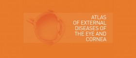 Cornea Atlas App, a collection of eye disease pictures with medical reference about each