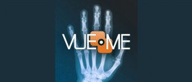 VueMe App, a cloud-based tool for patients to view, store and share their diagnostic medical imaging