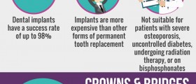 Are You Missing A Tooth? 3 Best Methods For Permanent Tooth Replacement