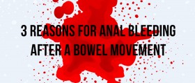 3 Reasons For Anal Bleeding After A Bowel Movement