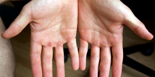 Volume Hacks For Tough Movements