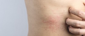 4 Things You Should Definitely Know About Skin Allergies