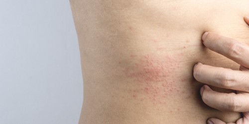4 Things You Should Definitely Know About Skin Allergies