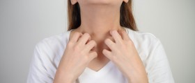 4 Things You Should Know About Managing Pruritus (Itching) When You Have Multiple Sclerosis