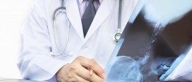 4 Ways Doctors Can Diagnose Arthritis
