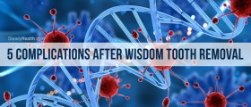 5 Complications After Wisdom Tooth Removal (And How To Prevent Them)