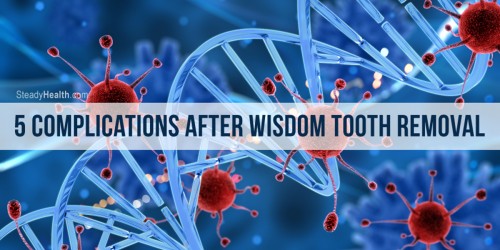5 Complications After Wisdom Tooth Removal (And How To Prevent Them)