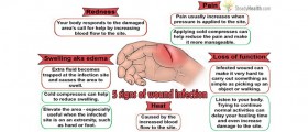 The Five Signs Of Wound Infection