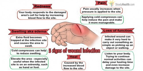 The Five Signs Of Wound Infection