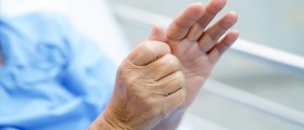 5 Surgical And Other Treatment Options For Thumb Arthritis