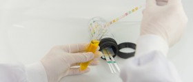 5 Ways To Diagnose A UTI: Tests And Procedures Used To Diagnose Urinary Tract Infections