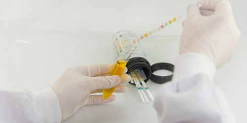 5 Ways To Diagnose A UTI: Tests And Procedures Used To Diagnose Urinary Tract Infections