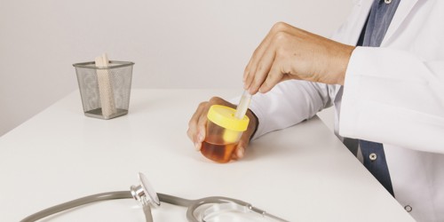 6 Surprising Risk Factors For Urinary Tract Infections