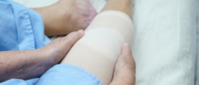6 Things You Should Know About Unicompartmental (Partial) Knee Replacement