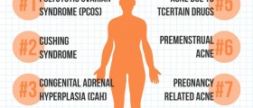 8 Medical Conditions That Might Cause Your Adult Acne
