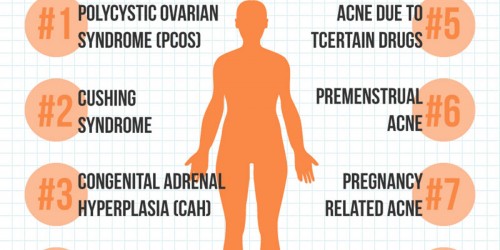 8 Medical Conditions That Might Cause Your Adult Acne