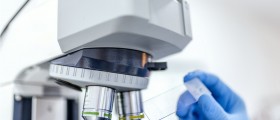 8 Potential Causes And Risk Factors Of ALS