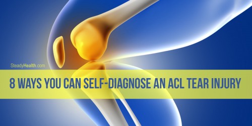 8 Ways You Can Self-Diagnose An ACL Tear Injury
