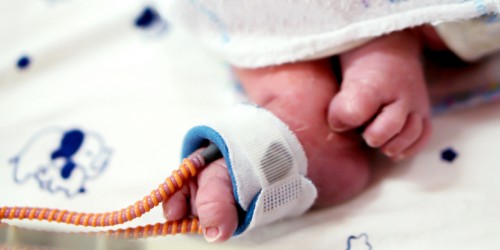 The Battle Of Premature Birth: How Does The Environment Of The NICU Affect The Family And Neonate?