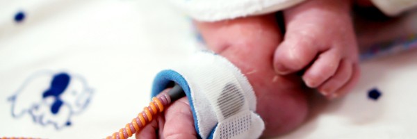 The Battle Of Premature Birth: How Does The Environment Of The NICU Affect The Family And Neonate?