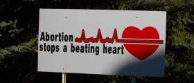 Trying To Conceive Reviews: The 180 Abortion Documentary