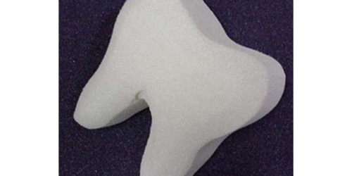 Abscessed Tooth: Symptoms & Treatment