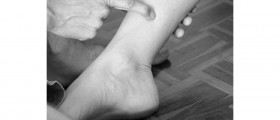 Laser Acupuncture May Help Bedwetters Break Nighttime Habit