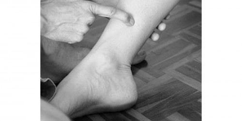 Laser Acupuncture May Help Bedwetters Break Nighttime Habit