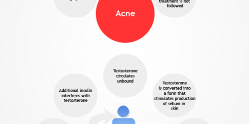 Acne and Carbs: Insulin Resistance Links Obesity and Acne, Study Shows