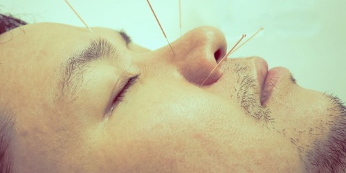 Acupuncture and Allergic Rhinitis: Is This A Safe and Effective Solution For Your Runny Nose?