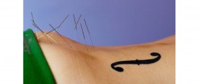 The Science Behind Medical Acupuncture