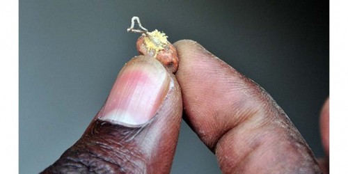 Safety Of Food And Recent Aflatoxin Scare In Europe