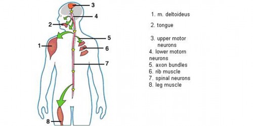 Diagnosed with ALS: Frequently Asked Questions